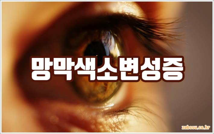 망막색소변성증 증상 원인 치료 완벽 가이드 망막색소변성증 증상 원인 치료 완벽 가이드